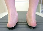 Photo of pronated feet corrected with orthotics